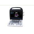 Color Doppler Ultrasound System For Hostipal